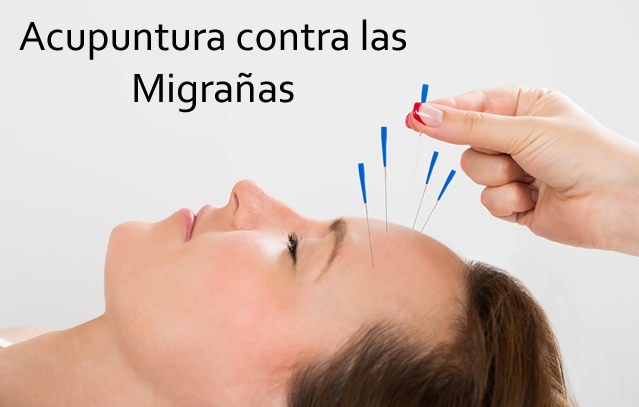 acupuntura migraña