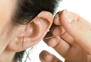 acupuncture therapy on auricle, horizontal very close up photo