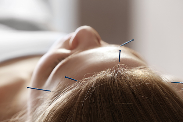 Tratar la ansiedad por comer con acupuntura
