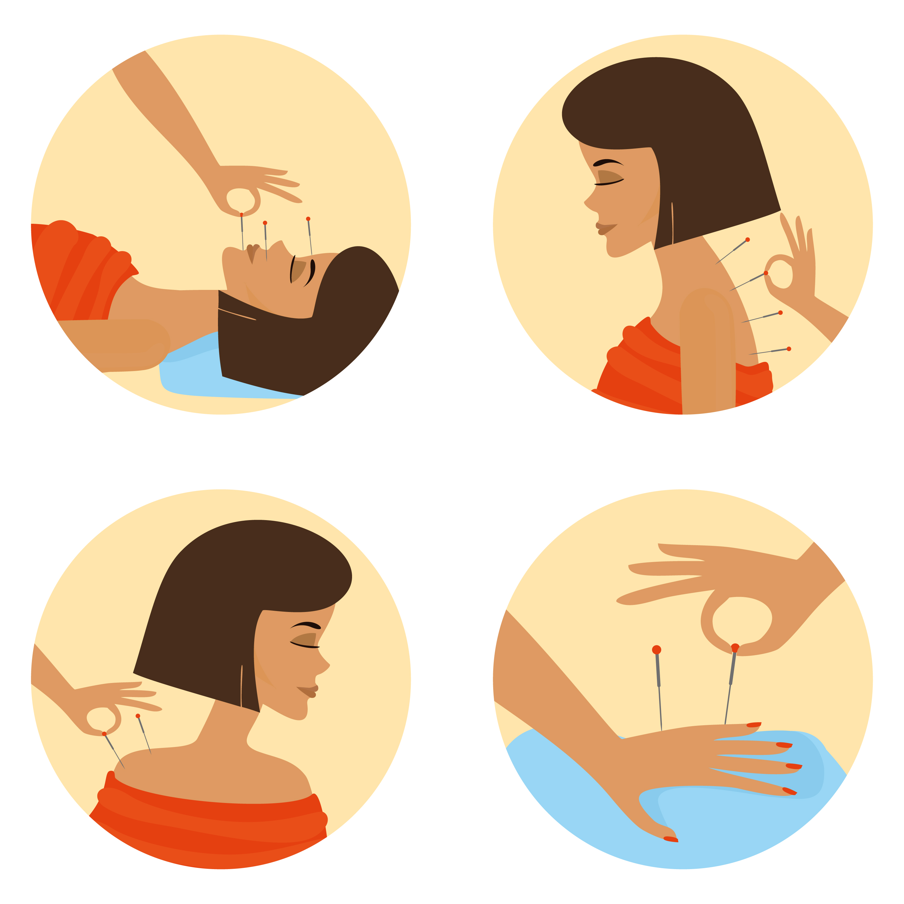 La acupuntura es un tratamiento eficaz para el dolor, según la ciencia